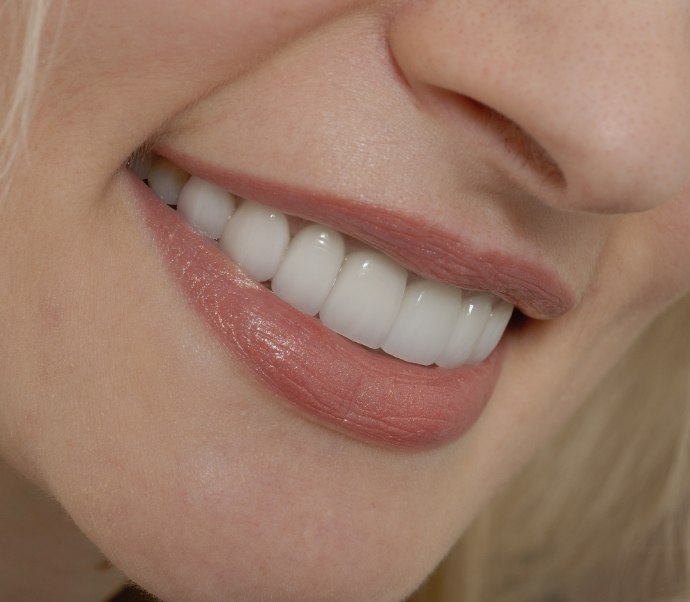 Close up of smile with flawless teeth