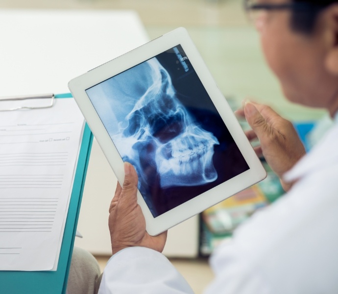 Dentist looking at x ray of jaws