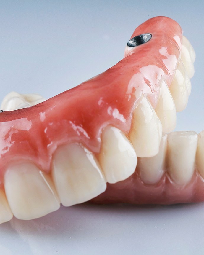 Closeup of two arches of dentures with connectors to anchor to implants