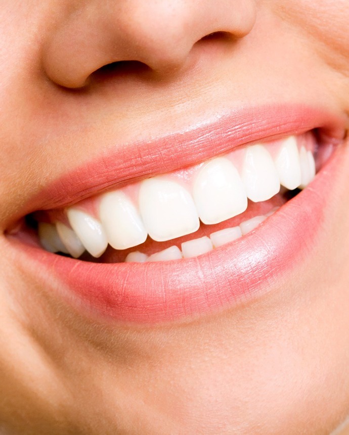 Close-up of woman’s beautiful smile with veneers