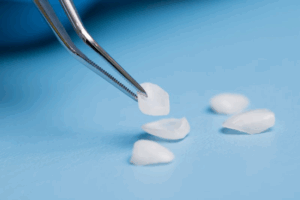 Tweezers picking up a dental veneer from a pile on a blue surface