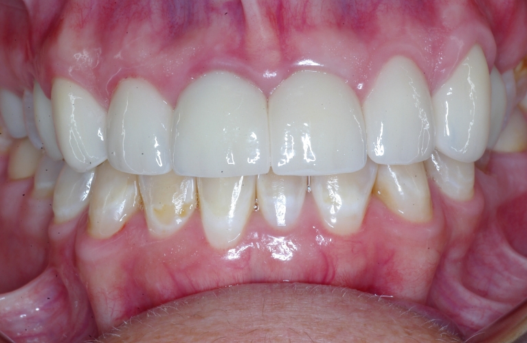 Case Fourteen - Featured